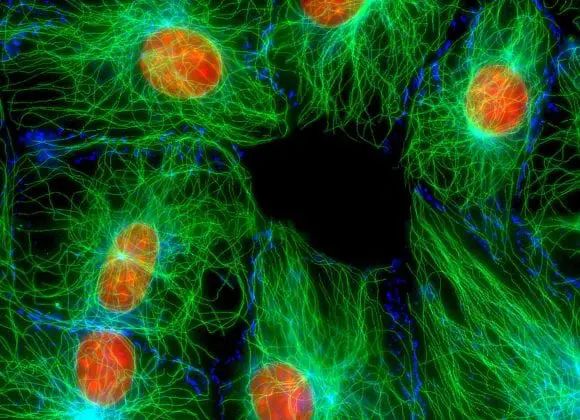 Optogenetica 1 Immagine grafica di rappresentazione dell'optogenetica