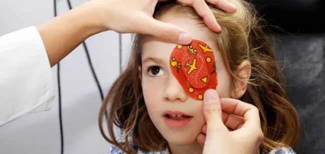 OCCHIO ALL’AMBLIOPIA! 2 Immagine rappresentativa di bimba affetta da ambliopia